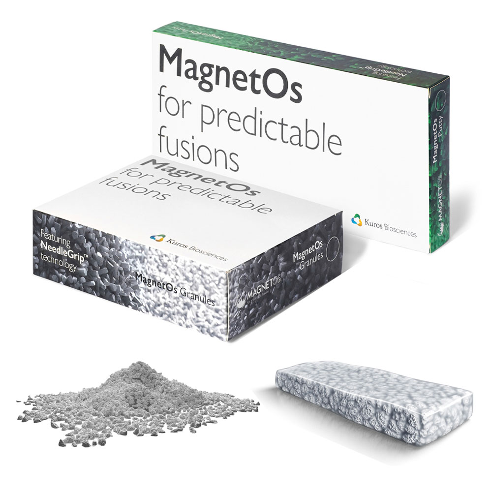 MagnetOS Bone Graft