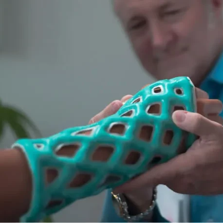 Cast21 orthopaedic casting fracture immobilization Australian Distributor