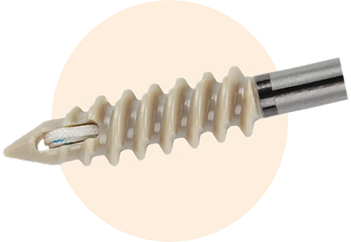 FastLock PEEK Suture Anchor