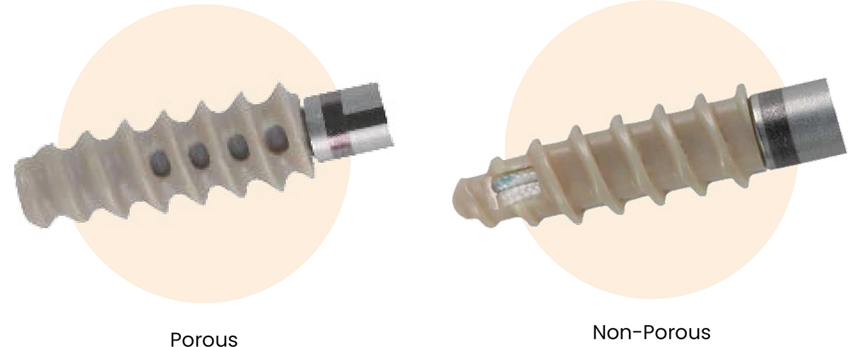 ProScrew PEEK Suture Anchor - Porous and Non-Porous