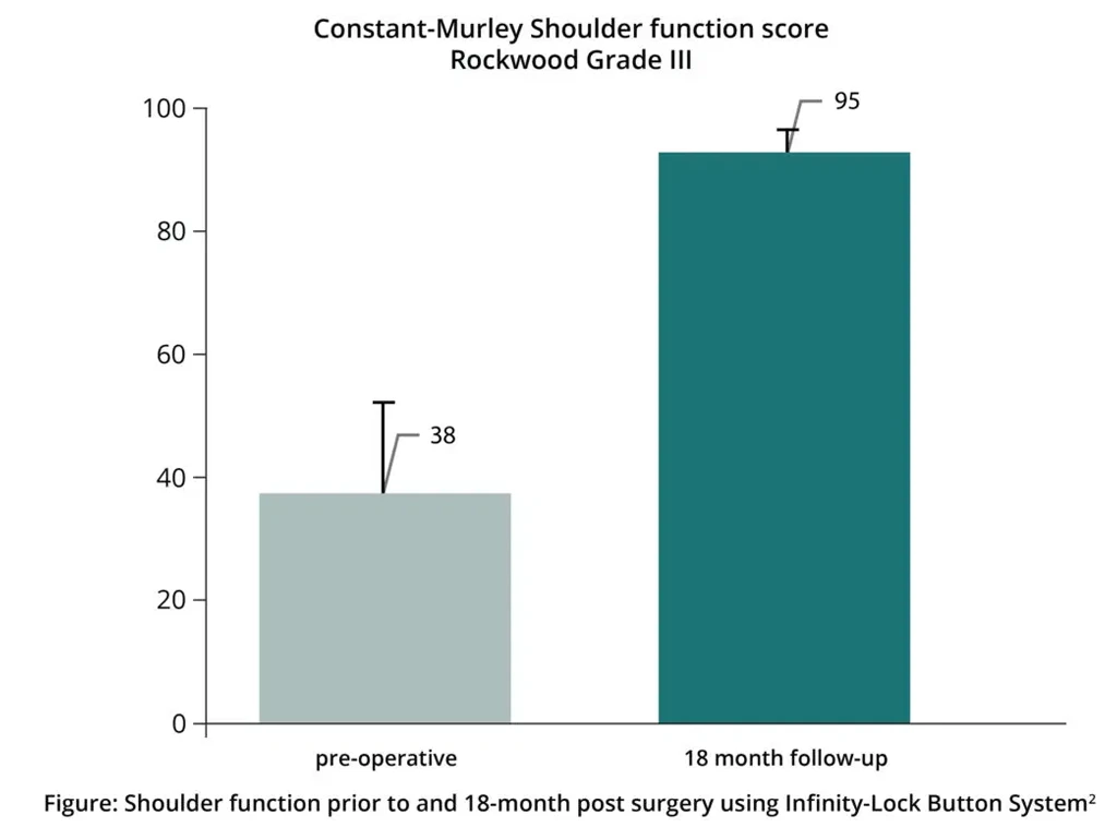 Graph of shoulder function prior to and 18-month post surgery using Infinity-Lock Button System