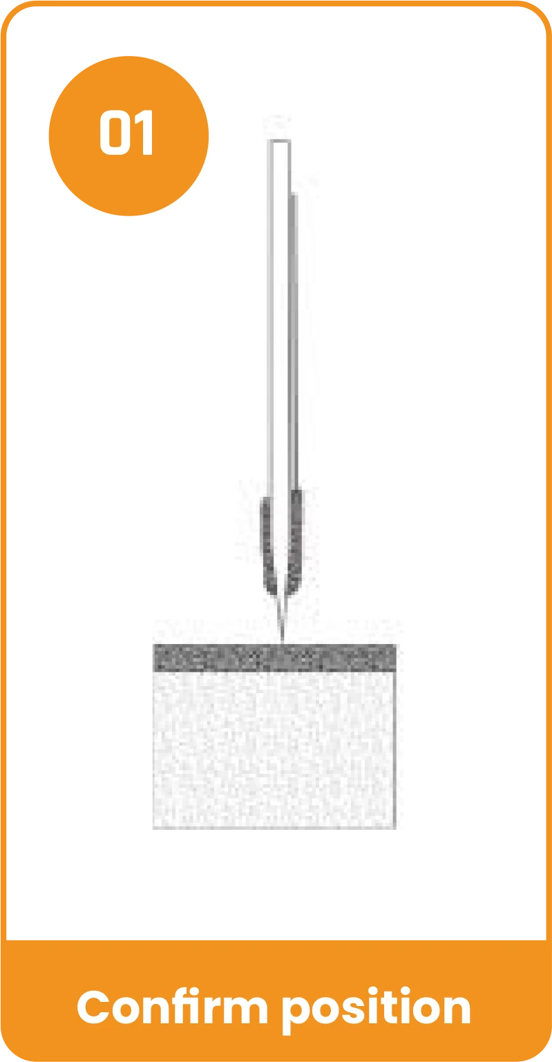 Y-Fix All Suture Anchor - Confirm position
