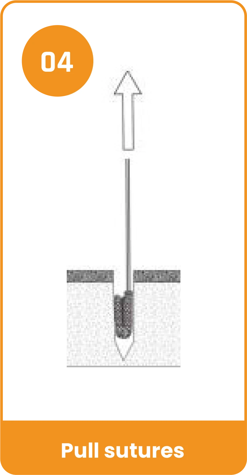 Y-Fix All Suture Anchor - Pull sutures
