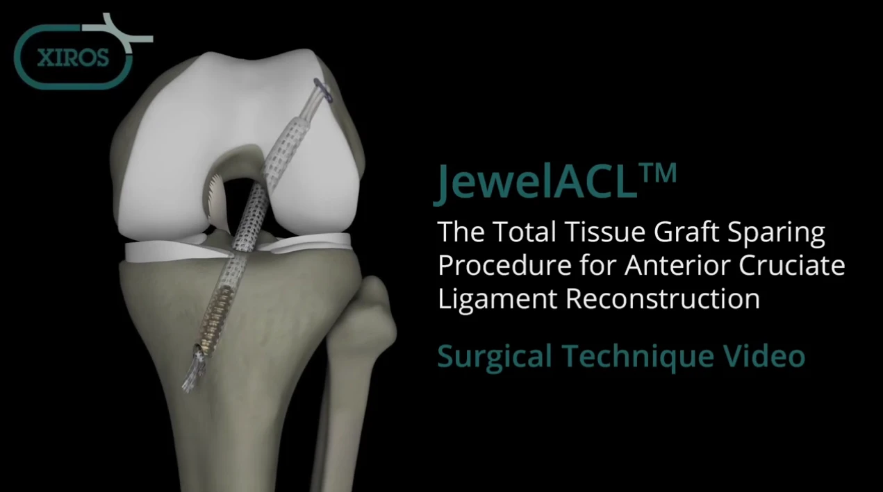 JewelACL